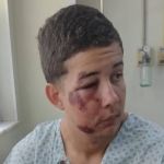 Jovem agredido por lutadores de MMA no Carnaval foi encontrado desmaiado pela mãe