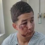 Jovem agredido por lutadores de MMA no Carnaval foi encontrado desmaiado pela mãe