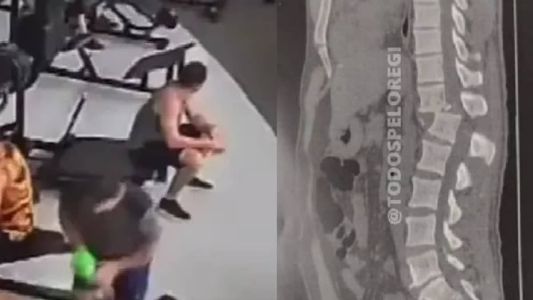 Regilânio fraturou a parte inferior da coluna (lombar) e não sente mais as pernas