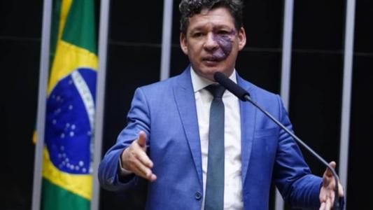 Reginaldo Lopes explica cronograma para implementação da reforma tributária