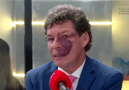 Deputado Reginaldo Lopes
