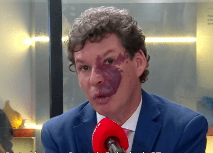 Deputado Reginaldo Lopes