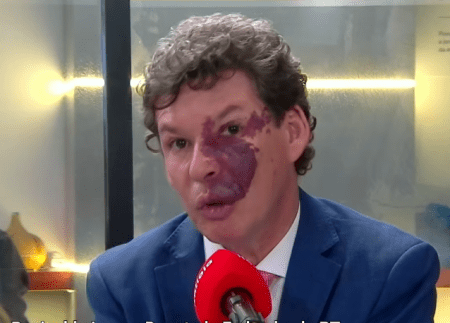 Deputado Reginaldo Lopes