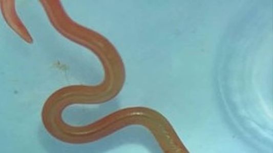 Relato é de um neurocirurgião que encontrou o verme na cabeça da paciente; caso é o primeiro no mundo