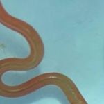 Verme de 8 cm é encontrado em cérebro de mulher: 'vivo e contorcendo'