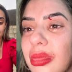 Repórter de TV chora e denuncia agressão do ex-marido: 'socou minha cabeça'