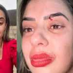 Repórter de TV chora e denuncia agressão do ex-marido: 'socou minha cabeça'