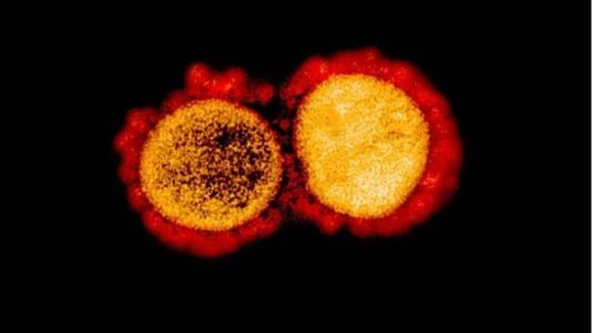 Representação do SARS-CoV-2, agente causador da covid-19