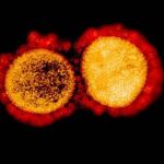 Pesquisa da USP usa ultrassom para destruir vírus da covid e influenza A