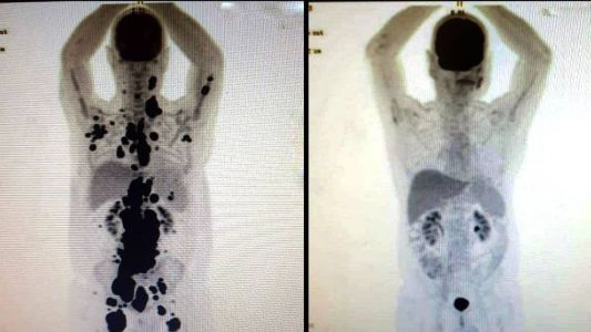 Resultado do tratamento é impressionante