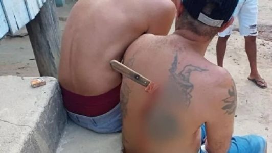 Homem ficou com faca cravada nas costas após discussão