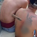 Homem fica com faca cravada nas costas após brigar com colega de trabalho