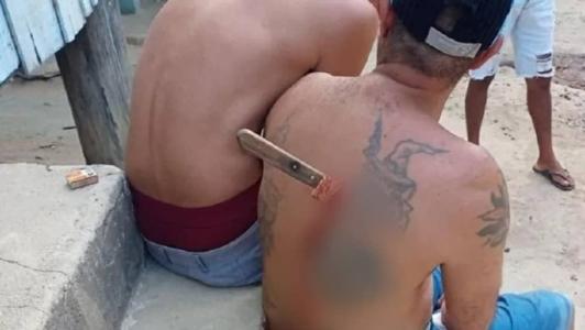 Homem ficou com faca cravada nas costas após discussão
