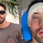 Rico Melquíades diz ter feito cirurgias plásticas por ser chamado de 'feio'