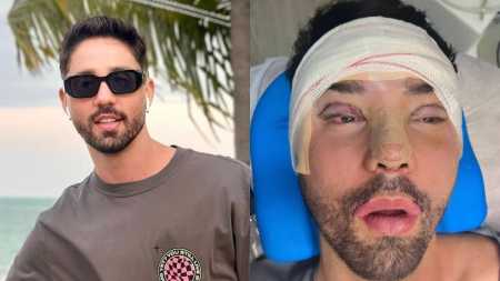 Rico Melquíades realizou diversos procedimentos estéticos após ataques de haters