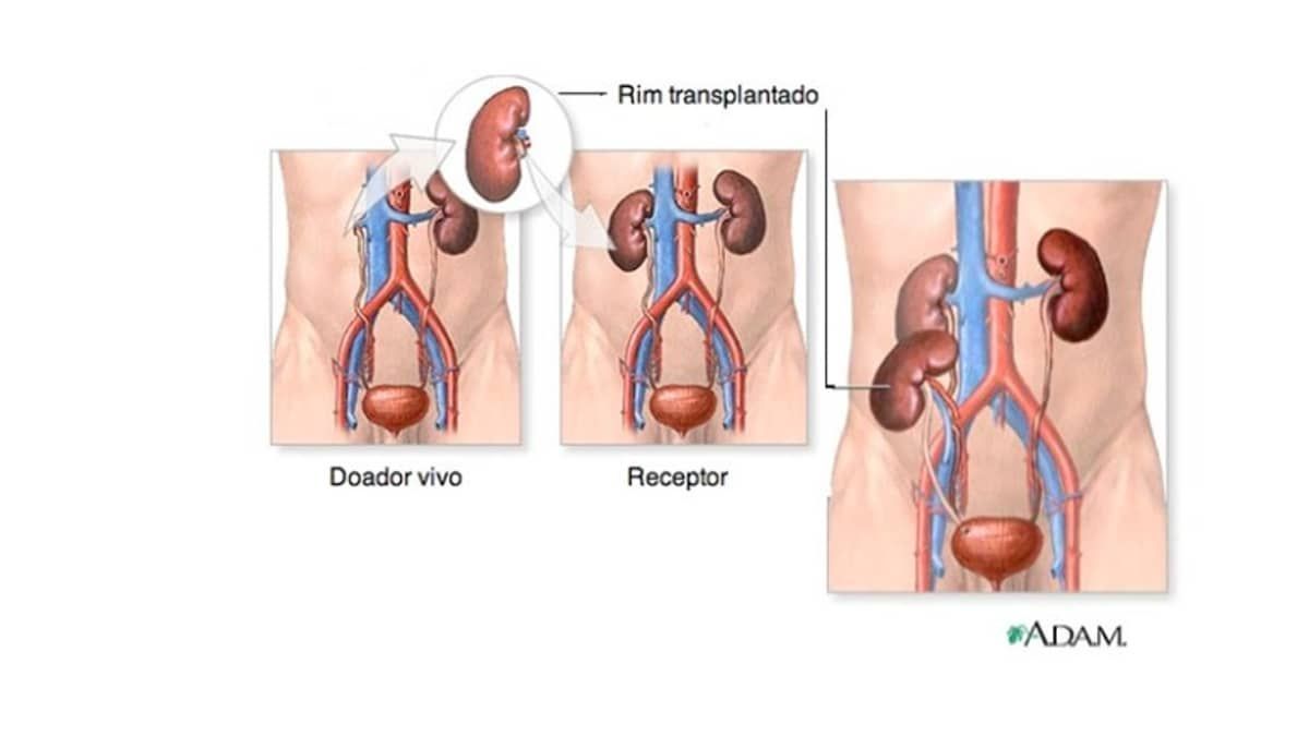 Três rins? Dois pâncreas? Médico explica dinâmica de transplantes de órgãos