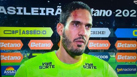 Goleiro Ronaldo, do Bahia, em entrevista pós-jogo