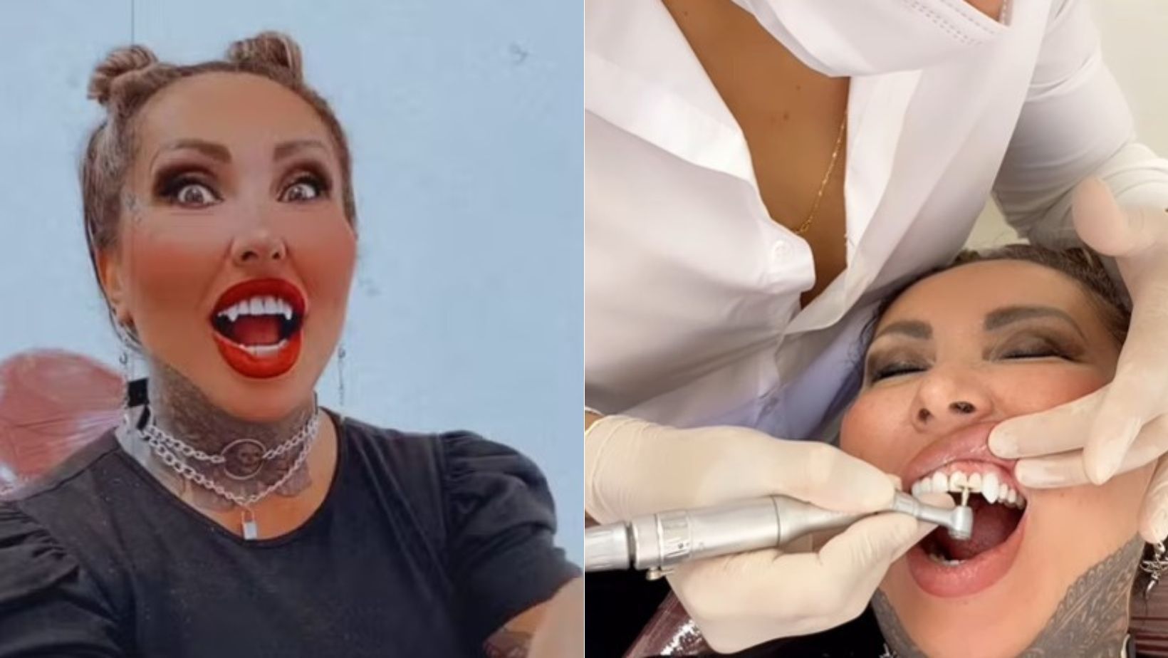 Vídeo: após colocar 6 litros de silicone, Sabrina Boing Boing troca dentes por 'presas felinas'