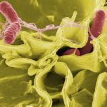 Estados Unidos têm surto de Salmonella provocado por pepinos e FDA toma medida radical