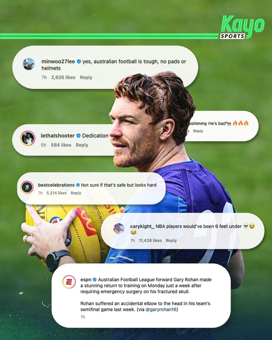 Jogador australiano volta a treinar uma semana após fratura e cirurgia no crânio