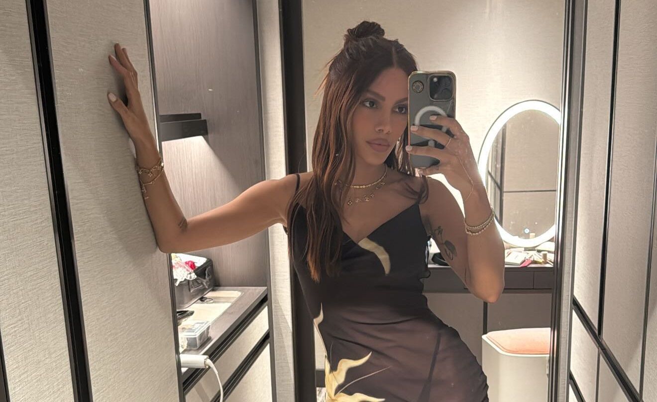 Anitta 'muda o rosto' e levanta discussão: escolha pessoal ou pressão estética?