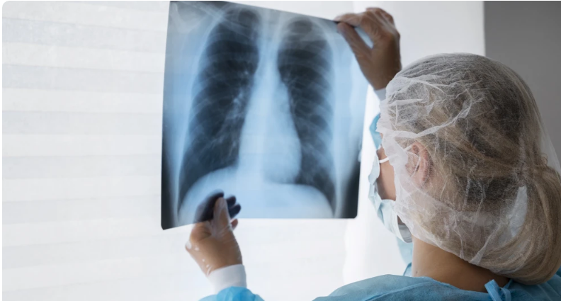 Casos de pneumonia registram crescimento em Ouro Preto