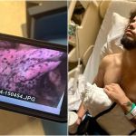 Lutador precisa retirar parte do pulmão por uso excessivo de vape; entenda