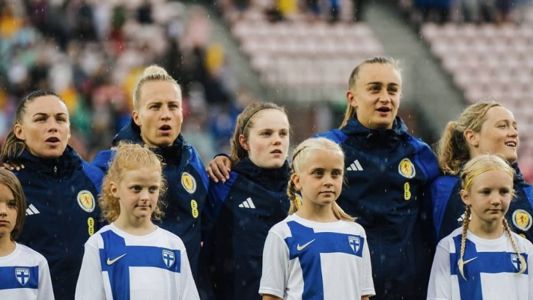 Seleção Escocesa durante partida amistosa