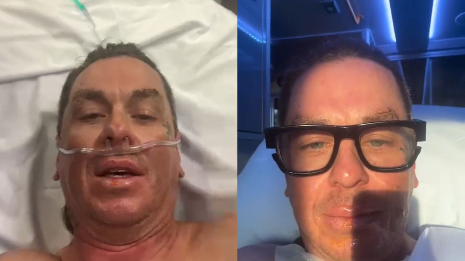 Sid Wilson, do Slipknot, atualiza estado de saúde após acidente doméstico: “já tive dias melhores”