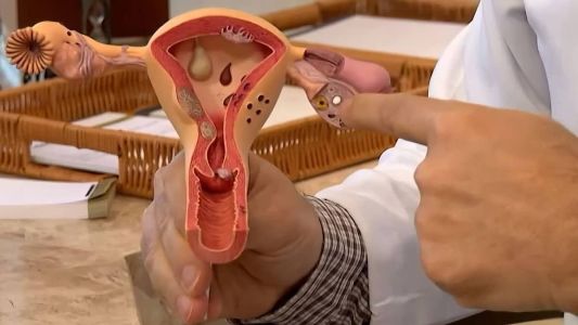 Sintomas como sangramentos incomuns e secreção vaginal fora do padrão devem ser investigados