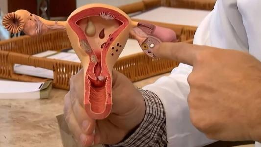 Sintomas como sangramentos incomuns e secreção vaginal fora do padrão devem ser investigados