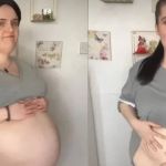 'Lutava para respirar’, diz jovem que retirou cisto de 16 quilos da barriga; assista
