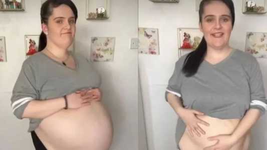 Siobhan Foster diz que cirurgia mudou a vida dela para melhor