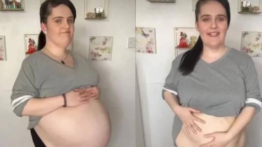 Siobhan Foster diz que cirurgia mudou a vida dela para melhor
