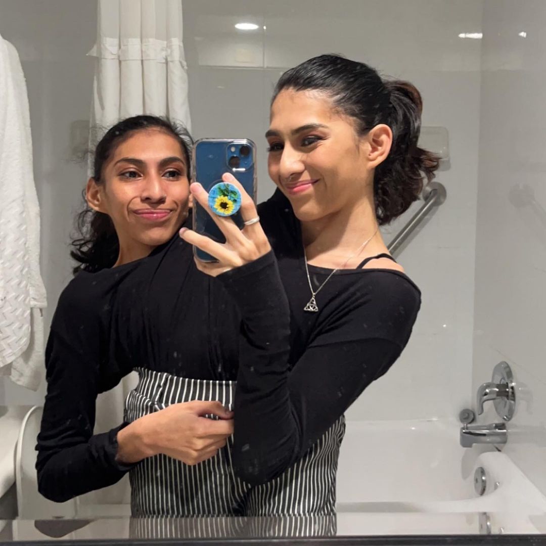 Gêmeas siamesas, unidas pelo tórax, respondem perguntas frequentes sobre namoro e dia a dia