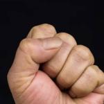 Homem que levou soco no olho em briga deve ser indenizado em R$30 mil no Sul de Minas