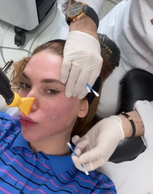 Transformações de famosos: procedimentos estéticos, harmonização facial e os impactos das redes sociais