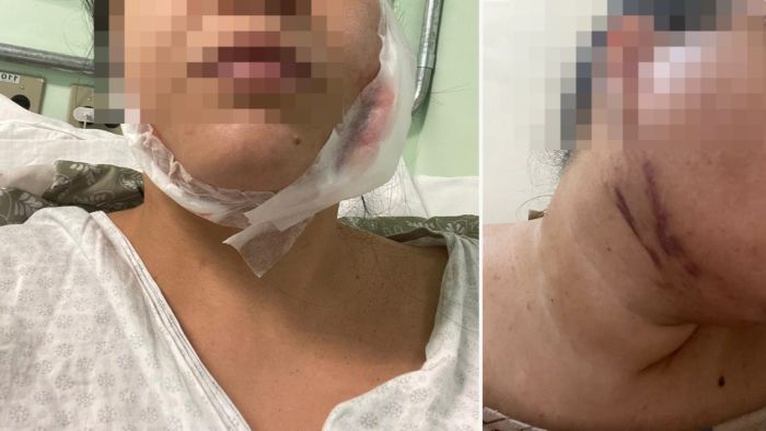 Foto mostra feridas em pacientes de dentista de Belo Horizonte