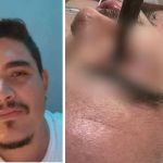 Homem que teve olho perfurado por taco de sinuca morre após um mês internado em MG
