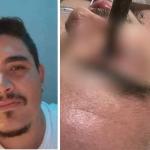 Homem que teve olho perfurado por taco de sinuca morre após um mês internado em MG