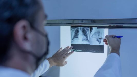 Tanto a fibrose pulmonar, quanto a cística, atingem o pulmão, mas são doenças diferentes