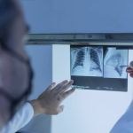 Saiba a diferença entre fibrose cística e fibrose pulmonar, doença que matou cantora Rita de Cássia