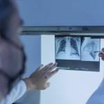 Saiba a diferença entre fibrose cística e fibrose pulmonar, doença que matou cantora Rita de Cássia