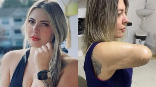 Tatuadora tenta prótese para continuar trabalhando