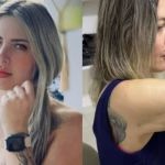 Vídeo: tatuadora que teve braço amputado após lipoescultura estava no ápice da carreira: 'sonho arrancado'