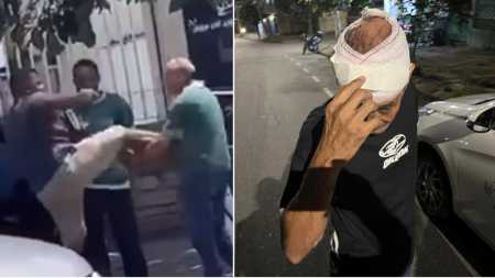 Fotos mostram taxista sendo agredido e, à direita, apresentando os ferimentos na cabeça