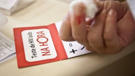 Técnica de edição de genes teve como objetivo agir tanto sobre o HIV quanto sobre um receptor