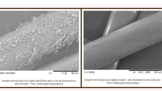 Técnicas da física são usadas para mostrar danos dos procedimentos à estrutura interna dos fios