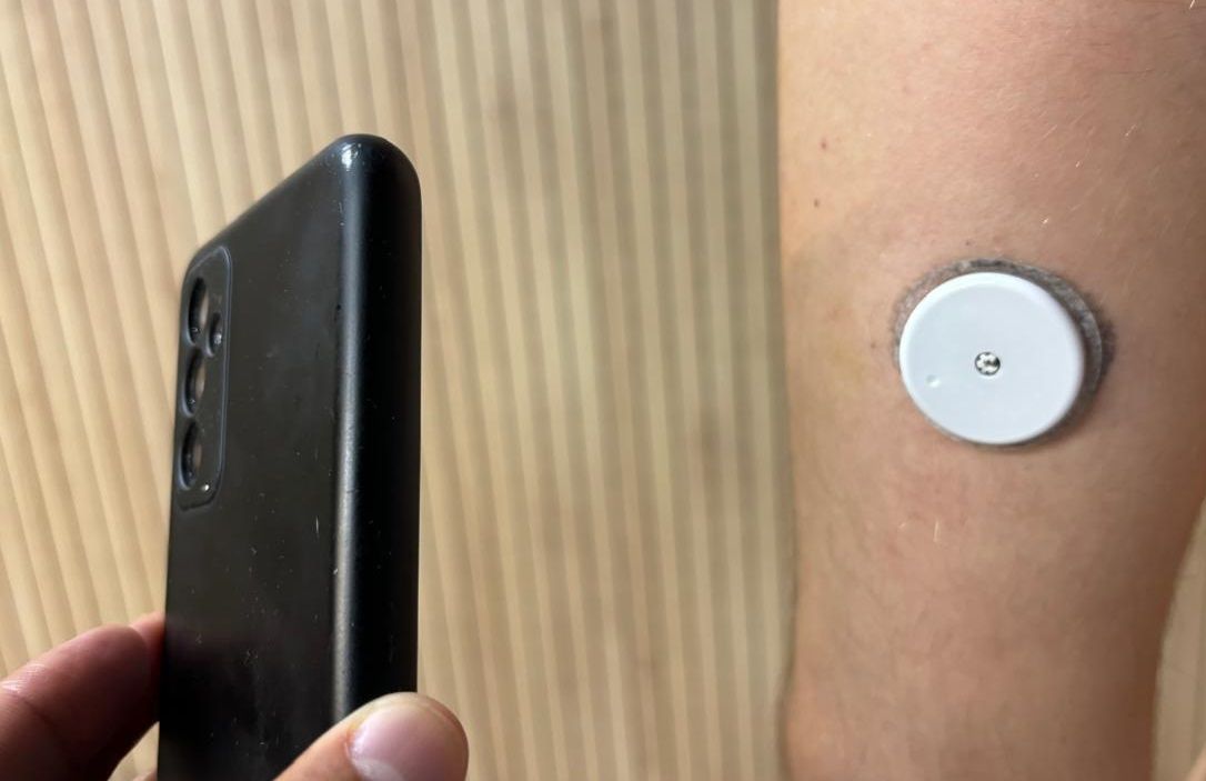 Adolescente com diabetes quer que eliminação após sensor de glicemia disparar mude regras do Enem