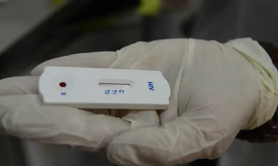 HIV: dados do SUS mostram queda no número de pessoas contaminadas no Brasil